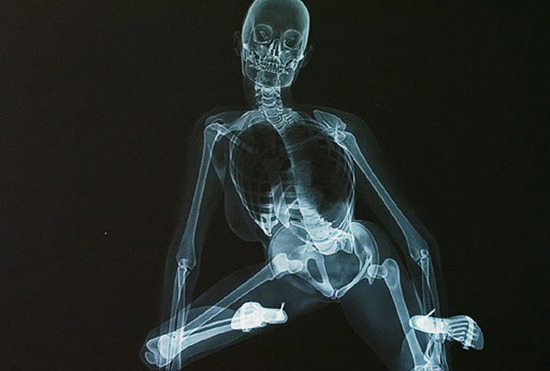 X光版<em>骨感美女</em> 全裸入镜三点不露-搜狐女人