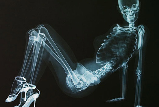 X光版<em>骨感美女</em>全裸入镜三点不露-搜狐女人